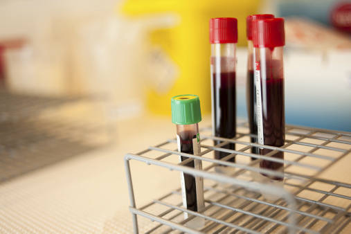 Fire reagensrør med blodprøver i et metallstativ