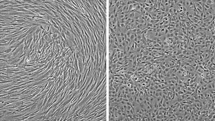 to bilder der bildet til venstre viser et lag av avlange celler og det til høyre viser runde små celler