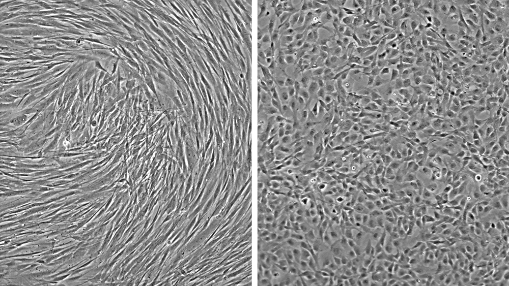 to bilder der bildet til venstre viser et lag av avlange celler og det til høyre viser runde små celler