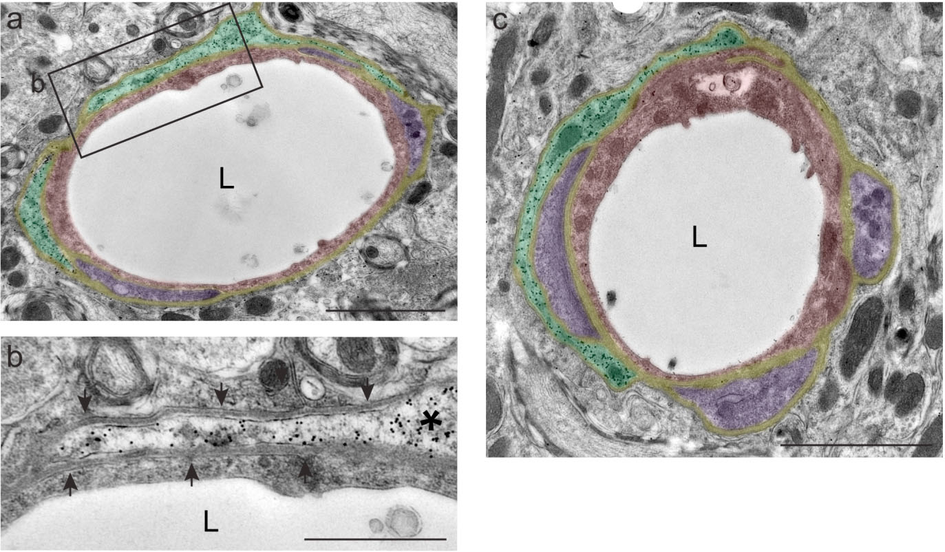 Immunogull elektronmikroskopi av glutamat aspartat transportør (GLAST) type A pericytter (grønn) i ryggmarg hos mus. 