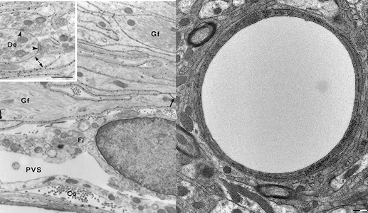 Left: Post-embedding electron microscopic immunogold cytochemistry showing aquaporin-4 (AQP4) immunogold labeling (black dots) along the glial lamellae in the subfornical organ of rat (Photo: Erlend Nagelhus, J neuroscience 1997) Right: Electron micrograph showing a brain capillary surrounded  by glial and neuronal compartments in a mouse brain section contrasted with uranyl acetate and lead citrate (Photo: Shreyas B. Rao, 2019)