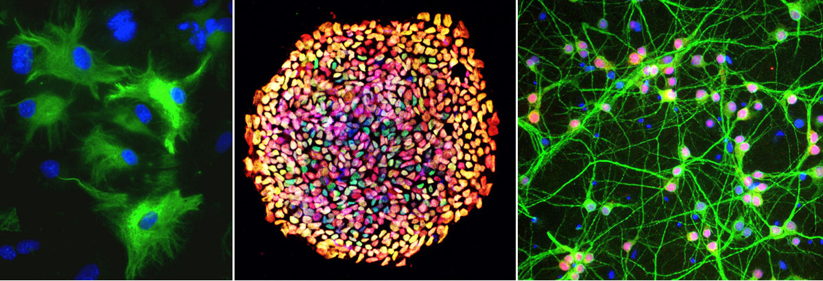 Konfokalbilder av iPS celler og differensierte celler