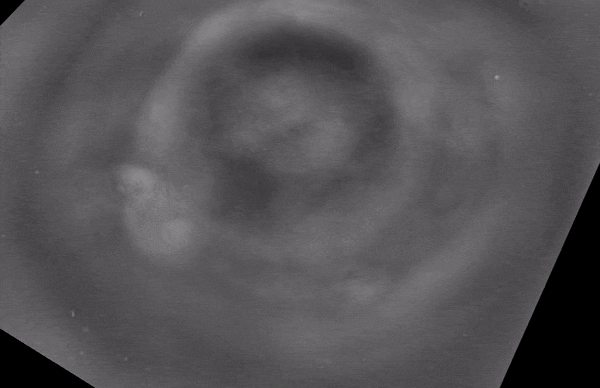 Image may contain: Grey, Medical imaging, Astronomical object, Monochrome photography, Circle.