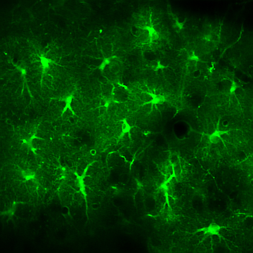 The star-shaped astrocytes from the neocortex of a mouse visualised by the genetically encoded calcium sensor GCaMP6f.