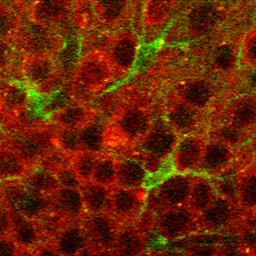Astrocytes in green and neurons in red in the hippocampus from an awake head-fixed mouse. 