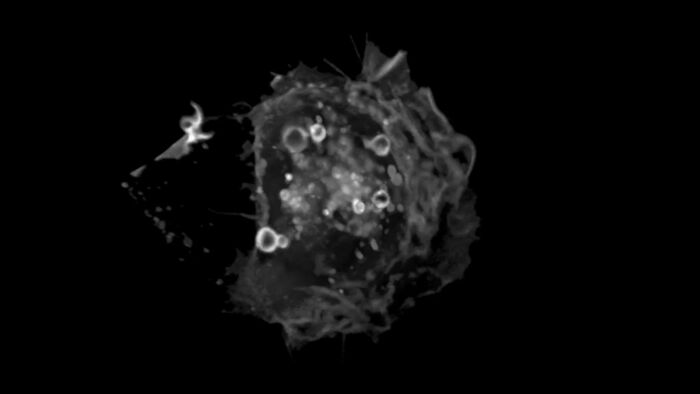 Image of a cancer cell with membrane ruffles and large vesicles - macropinosomes