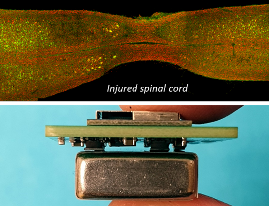Confocal picture of the spinal cord after lesion (top). Implantable Bluetooth transceiver. Photo: Jean-Luc Boulland, UiO 