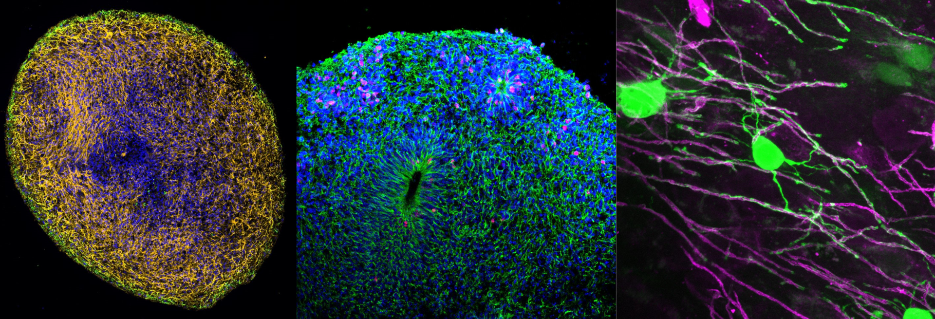 Microscopy-photo of organoids and oligodendrocytes