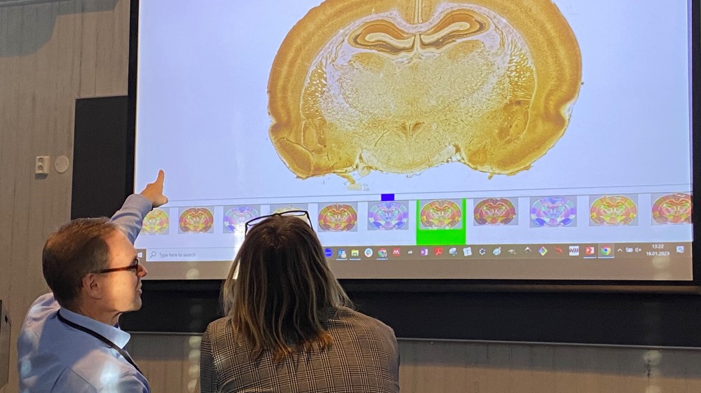 Image shows a man pointing at a large screen with an image of the brain