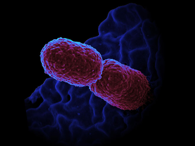 Microskop-bilde av bakterien som gir lungebetennelse