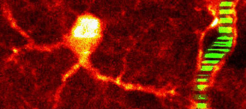 Bildet er tatt med et 2-foton lasermikroskop og viser en astrocytt med røde utløpere som kontakter en liten blodåre (grønn) i hjernebarken på en mus. Vannkanalene er lokalisert rundt blodårene, i enden av astrocyttutløperne. For å kunne ta bildet måtte selvlysende fargestoffer injiseres i hjernen og blodårene. 