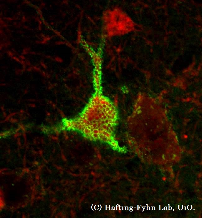 Mikroskopifoto av nerveceller.