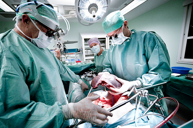  Old liver is removed by Trygve Thorsen (right); Eva Sagflaat Sødermann and Aksel Foss observe. Photo: Ram Gupta