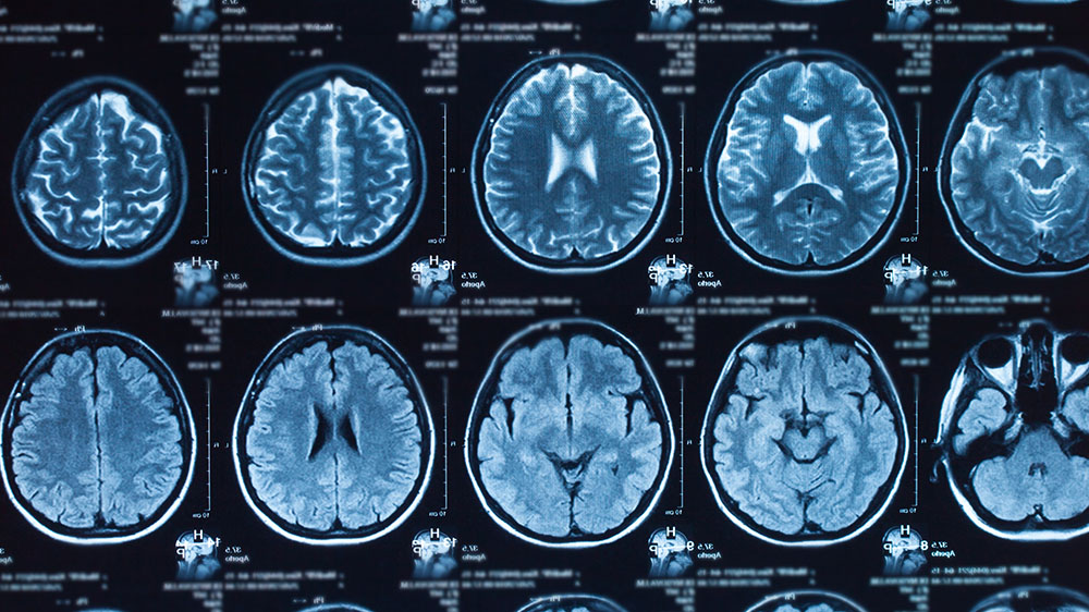 X-ray image of the human brain.