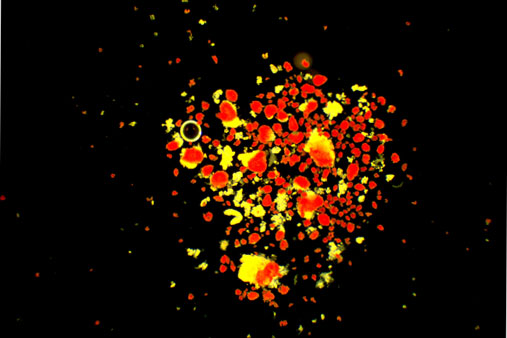 Bilde av betaceller fra de Langerhanske øyer i bukspyttkjertelen, tatt gjennom mikroskop