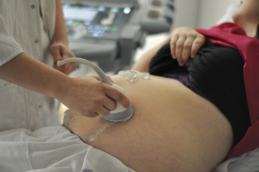 Ultralydudnersøkelse av gravid kvinne