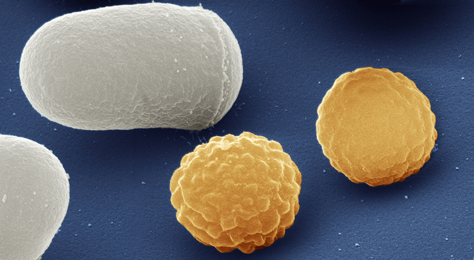 Picture of the fission yeast S. pombe. 