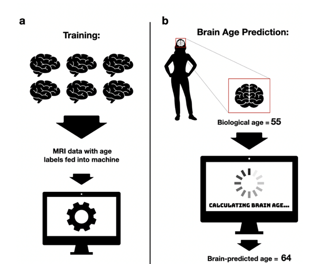 Visual presentation of brain age estimation