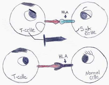 Øverst: T-celle dreper syk celle. Nederst: T-cellen lar en frisk celle være i fred.
