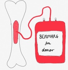 Tegning av donorbeinmarg som tappes over på "blodpose".