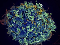 Bilde av HIV-virus