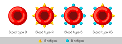 Tegning av fire blodceller med hhv ingen antigener, A-antigen, B-antigen og både A- og B-antigen.