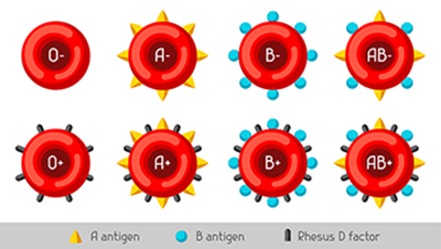 Tegning av åtte blodceller. De fire øverste er de samme som i figur 1. De fire nederste er også disse cellene, men nå med RhD-antigenet på overflaten også.