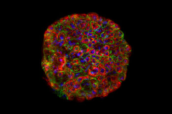 mikroskopbilde av en rund klump med fluorescerende (grønne, blå og røde) celler.