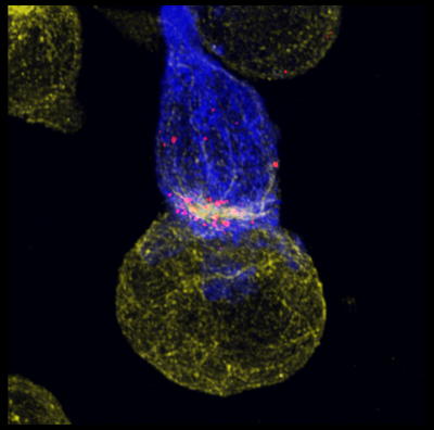 Fluorescensmikroskopibilde, svart bakgrunn