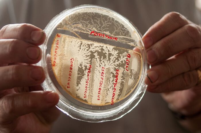 fingre, plate med bakterier