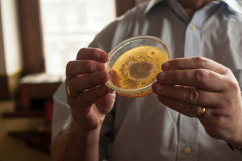 hand, fingers, antibiotic resistance bacteria